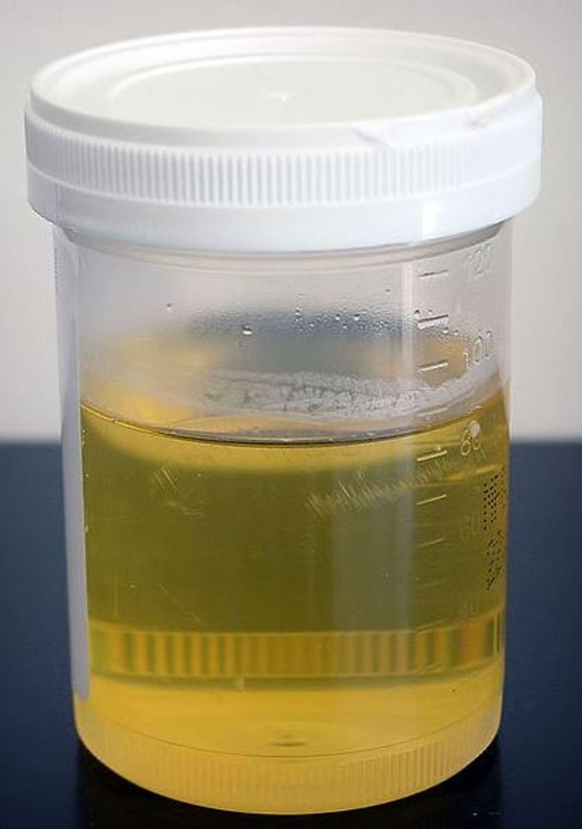 Why Is My Dog Pee Green Understanding The Possible Causes